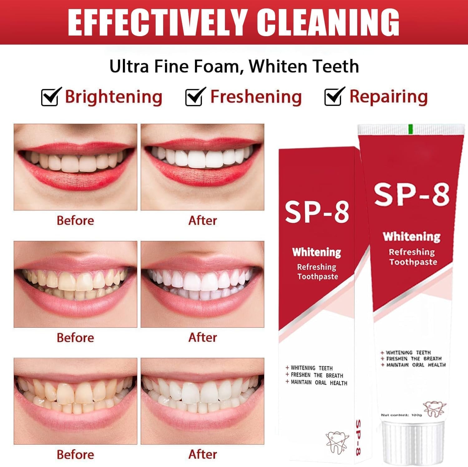 SP-8 Probiotic Toothpaste,Super Probioticsp-8 Toothpaste,Sp8 Ultra Whitening Toothpastes,Sp 8 Toothpastes Fresh Breath,Deep Cleaning Care (1)